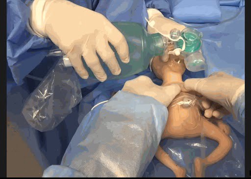 Inspire Femeba 2024 RN AR